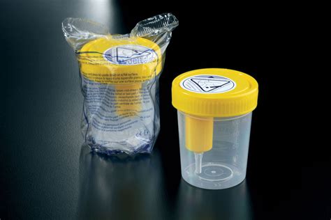 bottle urine test|urine sample bottles nhs.